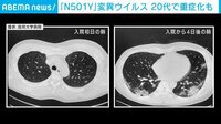 「N501Y」 20代でも重症化