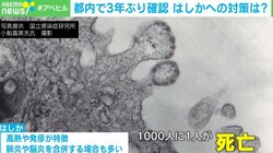 はしか予防接種「2回目は忘れがち」 打ったかわからない人は？ 医師に聞く