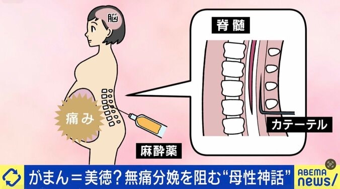 「無痛分娩」を阻む“母性神話”