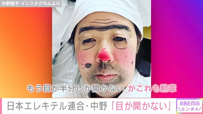 「目が半分しか開かない」 日本エレキテル連合・中野聡子、“テープメイク”酷使で眼瞼下垂に「真似しないで」 1枚目