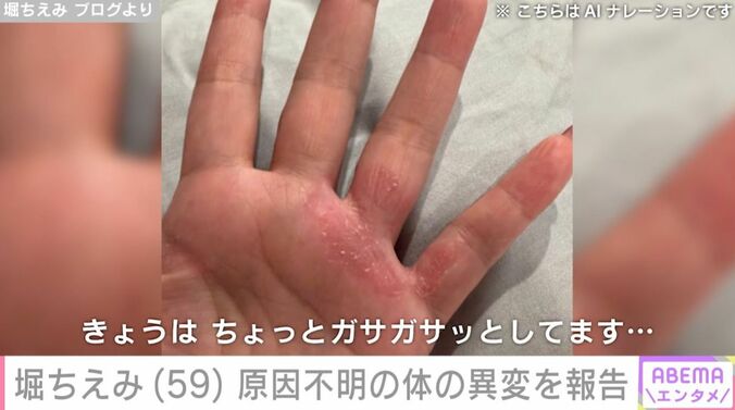 堀ちえみの手