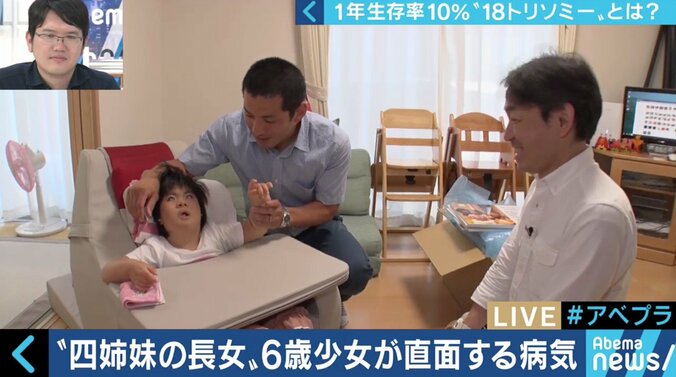 “1年以上の生存率は10％”…18トリソミー児の家族たちが写真展に託した苦悩と葛藤 7枚目