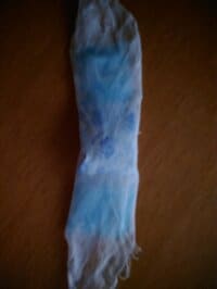 秋野暢子『痒みとバトル』