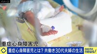 意識がない娘を24時間在宅でケア 重症心身障害児を授かった夫婦の日常