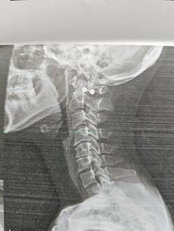 小原正子、“かなり悪い”と診断された病名を明かす 「早く治ると良いですね」「大変ですね」の声