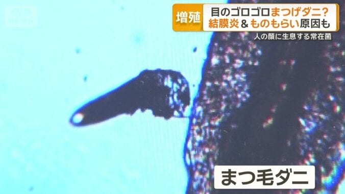 イモムシのような形をして動く「まつ毛ダニ」