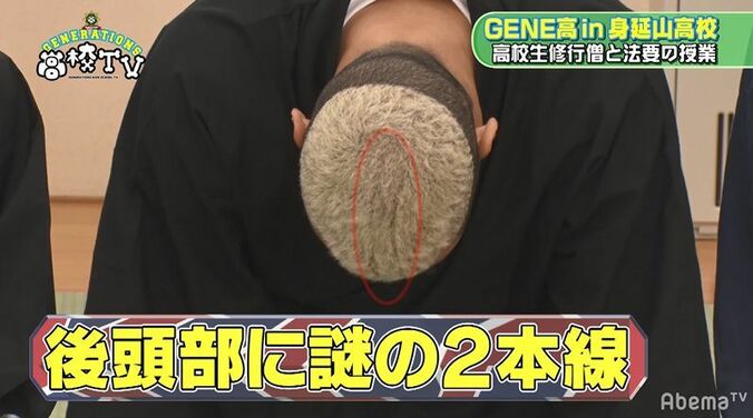 メンディーの頭に異変！？亜嵐が発見「頭、ちょっと下向けて！」 7枚目