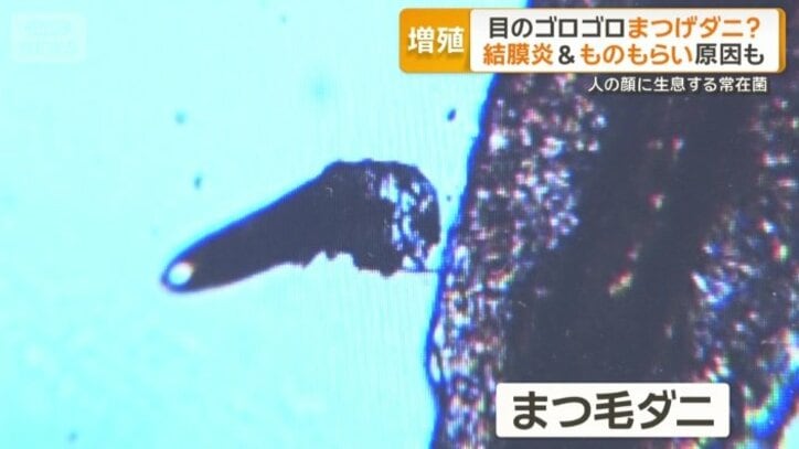 イモムシのような形をして動く「まつ毛ダニ」