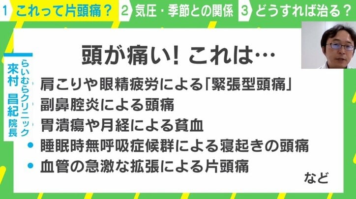 柴田阿弥「生産性爆下がり」の原因は”片頭痛” 脳の病気?不安も…専門医に聞く最新治療法