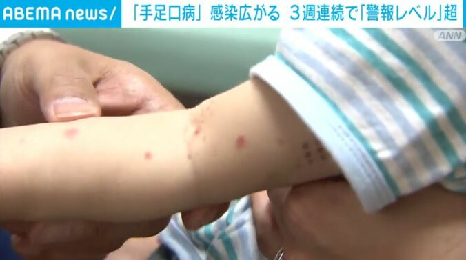 子どもの腕