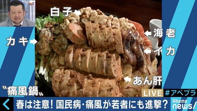 若者・女性の患者も増加！国民病“痛風”を予防するには？ 3枚目