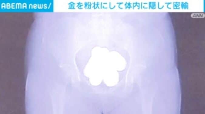 体内に隠された金