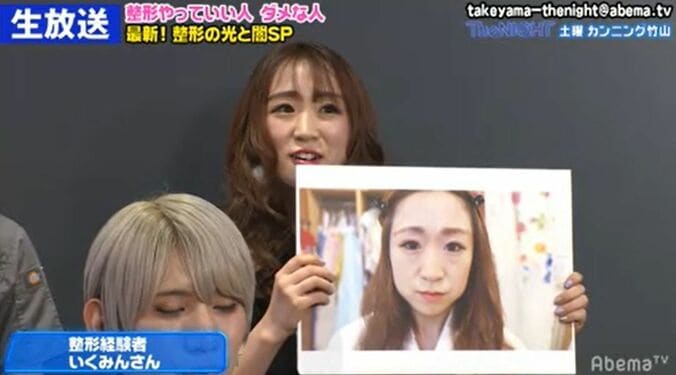 格安？ 危険？ 経験者が語る韓国と日本の整形事情 1枚目