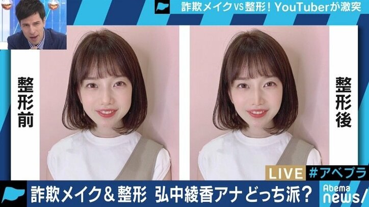 メイクと整形、あなたはどちらを極める?リアルを伝え続ける人気YouTuberに聞いてみた