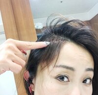 キンタロー。『髪の毛』