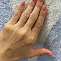 矢沢心『わたしの手荒れ事情』