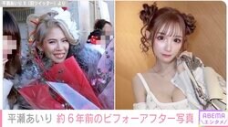“整形総額2000万円”「できることは全部やった」平瀬あいり、約6年前のビフォーアフターショットを公開
