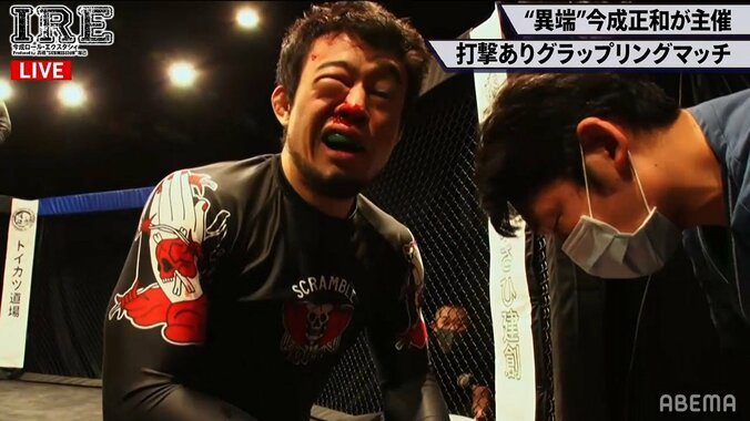 あわや顔面破壊の衝撃TKO決着に「顔ヤバい」「MMAより危険」 “掌底”の威力に戦慄 1枚目