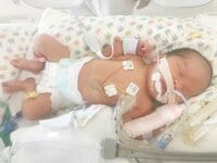 松本美奈子『緊急帝王切開＊産後2日目＊ベビーの心臓に穴！』