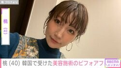 “3度の二重整形” 桃（40）、 韓国で顔の美容施術受けたビフォアフ公開 帰国時にはまさかの出来事