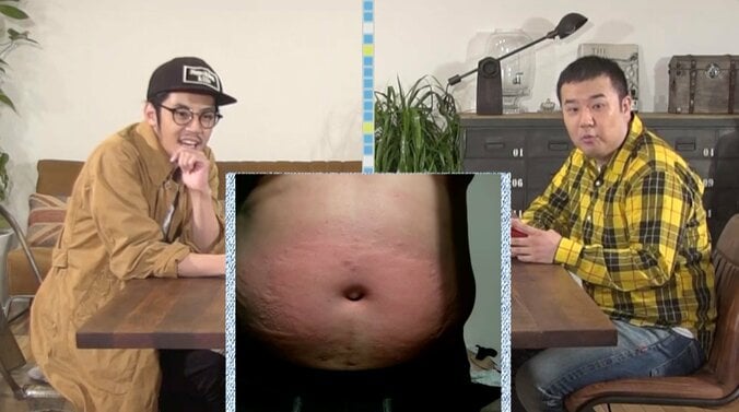 インパルス・堤下、事故について言及「まだ免許ある」 アレルギー症状の写真も公開し弁明 2枚目