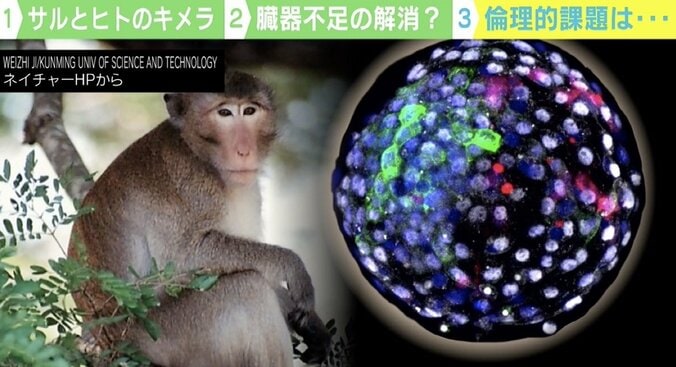 サルがヒトの臓器不足を解消？ 世界中で生命倫理に懸念の声「議論内容の発信を」 1枚目