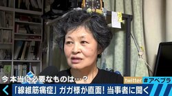 痛みとの付き合いは“スイッチ”の入れ方、線維筋痛症友の会・理事長「表では元気な姿を見せたい」