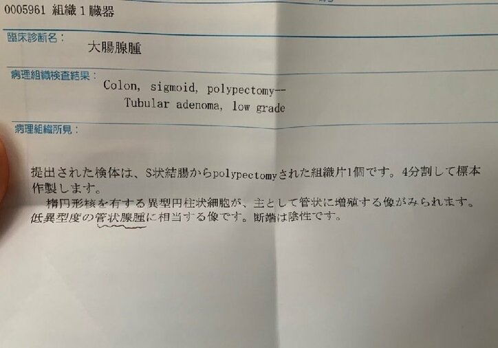 あいのり・桃、切除したポリープの検査結果「本当に受けて良かった…」