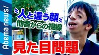 “人と違う顔”見た目問題持つ人生は？ 当事者が生出演