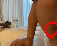 川崎希『蜂に刺された❓』