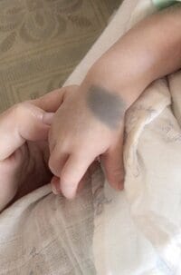 相沢まき、娘の“異所性蒙古斑”について明かす「なかなか痣だらけ」