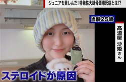 「両方の股関節と膝が壊死した」女優を目指した若い女性の告白 発症率5万人に1人の難病は「反対にへし折られている痛み」