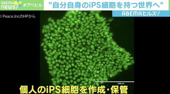 髪の再生、老化防止も…“iPS細胞”は個人が持つ時代？ 約1億円の作製費用も低コストに 4枚目