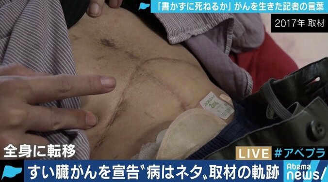 ”書かずに死ねるか”「記事を書く」ことと「伝える」ことの違いは？すい臓がんで亡くなった記者が投げかける、政治とメディアの課題 2枚目