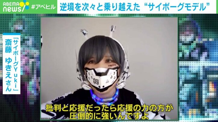 コンプレックスを武器に! 技術と発想の転換で逆境を乗り越えた“サイボーグモデル”