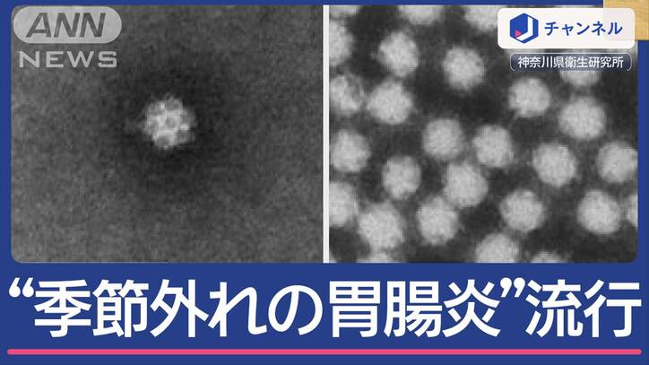 “季節外れの胃腸炎”流行　ノロウイルスに似た「サポ」「アストロ」とは？