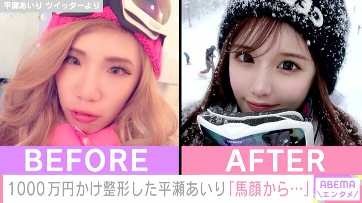 整形総額1000万円グラドル・平瀬あいり、衝撃のビフォーアフターを公開し話題に「この変わり方は夢ありますね」
