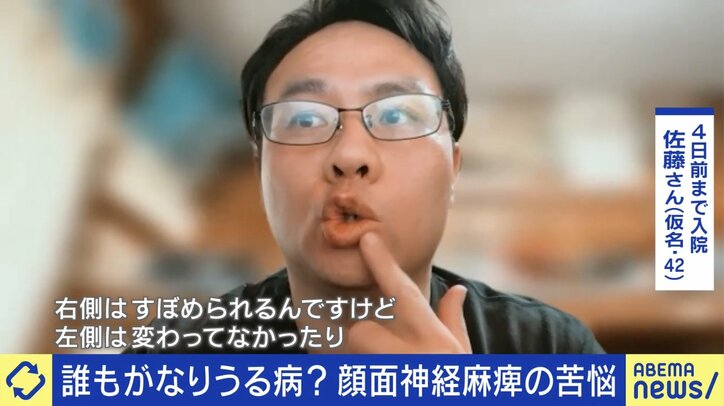 数日前まで“顔面神経麻痺”で入院していた佐藤さん