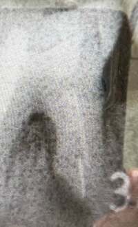 松居直美『私の歯の根には。。。』