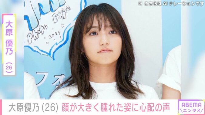 【写真・画像】大原優乃（26）、顔が大きく腫れた姿に心配の声「大丈夫ですか？」「かなり痛そう」　1枚目