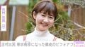 子宮頸がん“再々再発”古村比呂(60)、頭皮の帯状疱疹で抜け落ちた髪のビフォーアフターを投稿