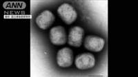 サル痘「初期症状なく感染拡大か」発熱や悪寒見られず