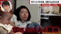 Abema的ニュースショー【日曜ひる12時~生放送】 - 名場面 - 10万人に1人の難病 体重20kgの女性が奇跡の出産 夫婦の葛藤とは | 動画視聴は【Abemaビデオ(AbemaTV)】