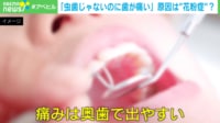 「虫歯じゃないのに歯が痛い」原因は“花粉症”?