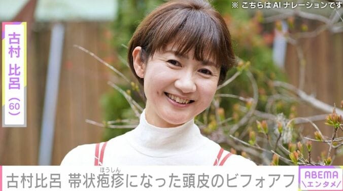 古村比呂