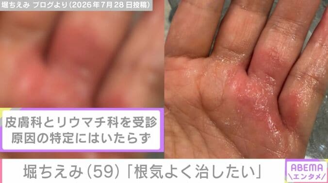 堀ちえみの手