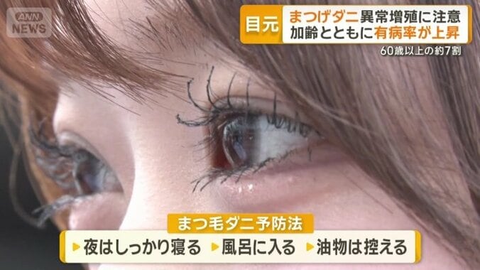 すぐにできる予防法