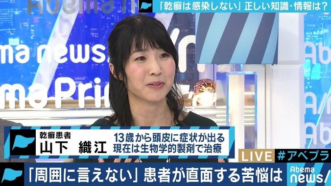 患者が告白「結婚は難しいと言われショックを受けた」　道端アンジェリカも誤解と偏見に苦しむ「乾癬」とは 7枚目