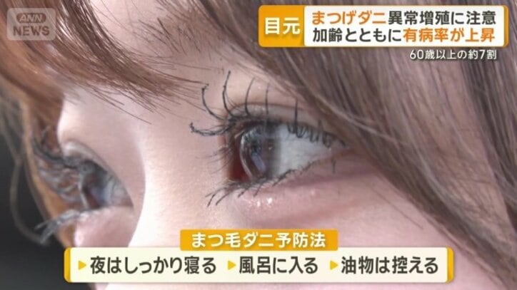 すぐにできる予防法