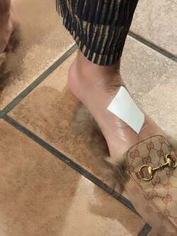  川崎希、夫・アレクが負傷し再度病院を受診した結果「綺麗に治るといいな。。。」 